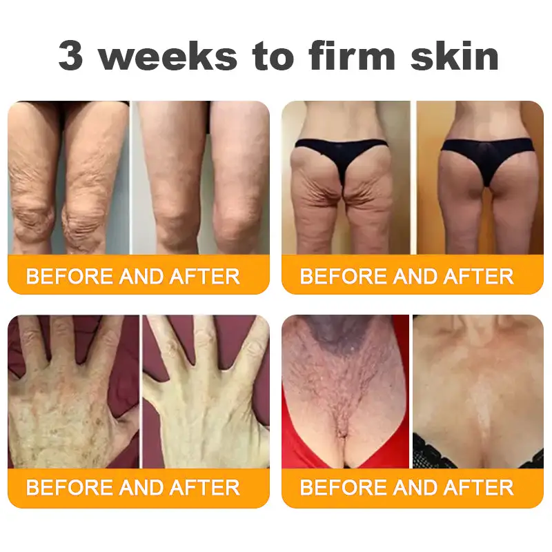 LOVILDS™ Bee Poison Skin Restoration Cream 👨⚕️(🔥LAST DAY SALE-80% OFF)🥇👩⚕️