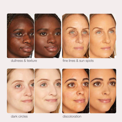 BBOJI® Moisturizing Concealer BB Cream SPF 30+ FREE Brush